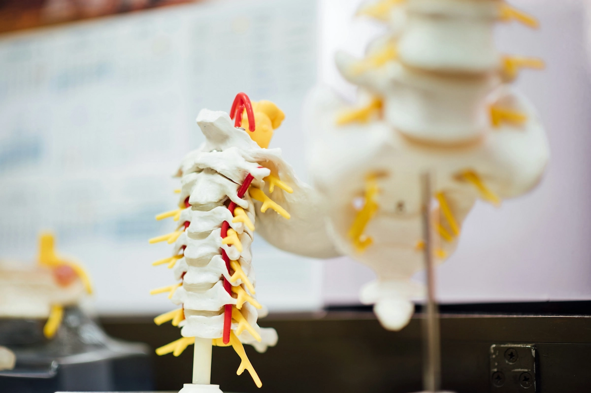 Close-up of a white anatomical model of the human cervical and thoracic spine, showing vertebrae, yellow nerves, and red arteries. Another blurry spinal model is in the background.